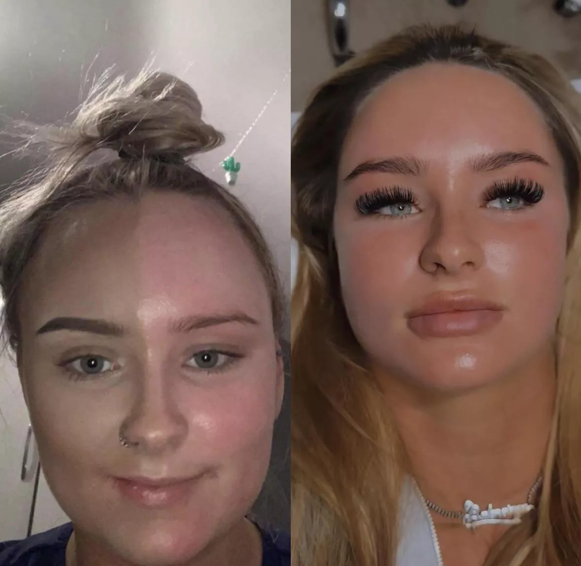 The difference three years (and various surgeries) can make! 😊