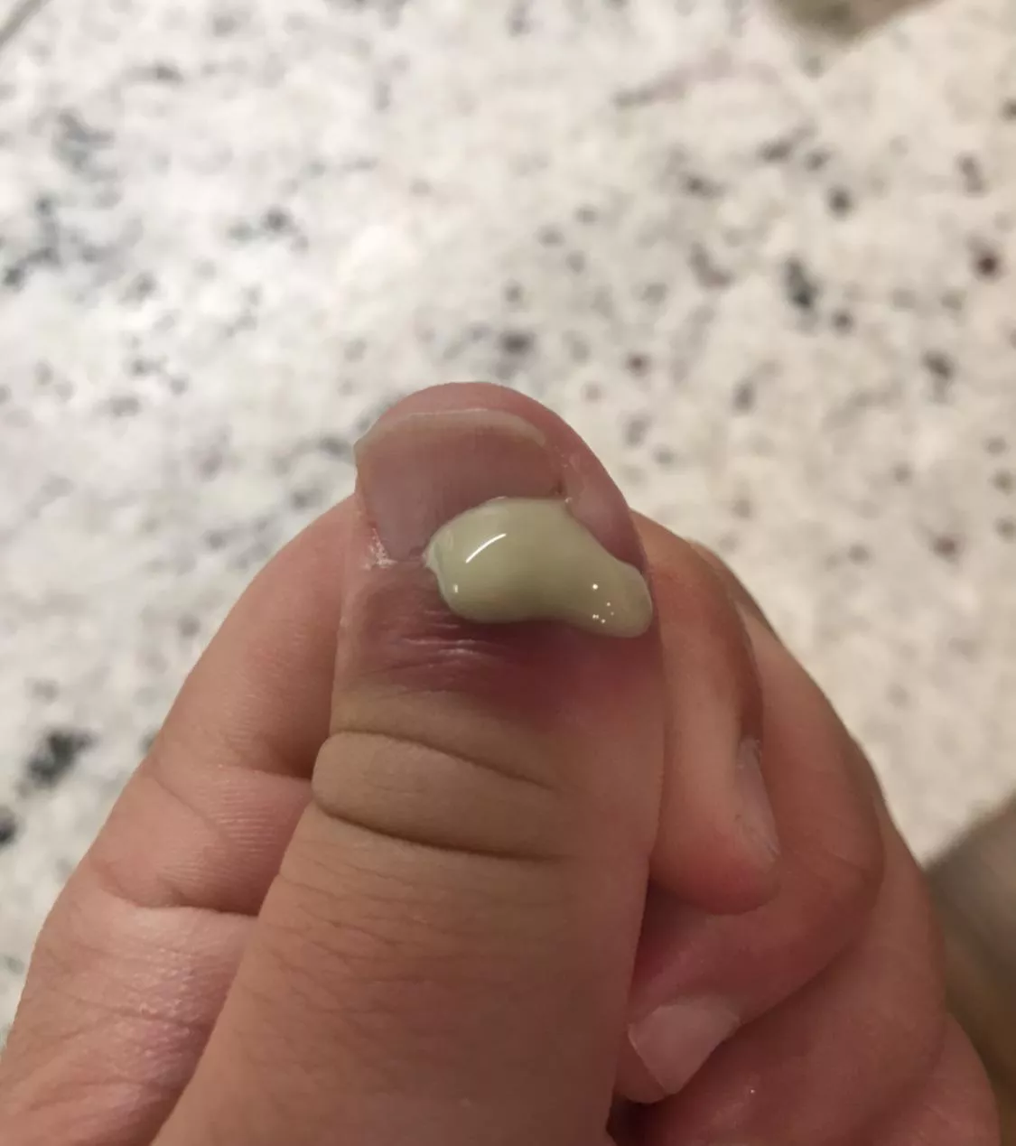 This hurt a lot but I’m feeling much better now.