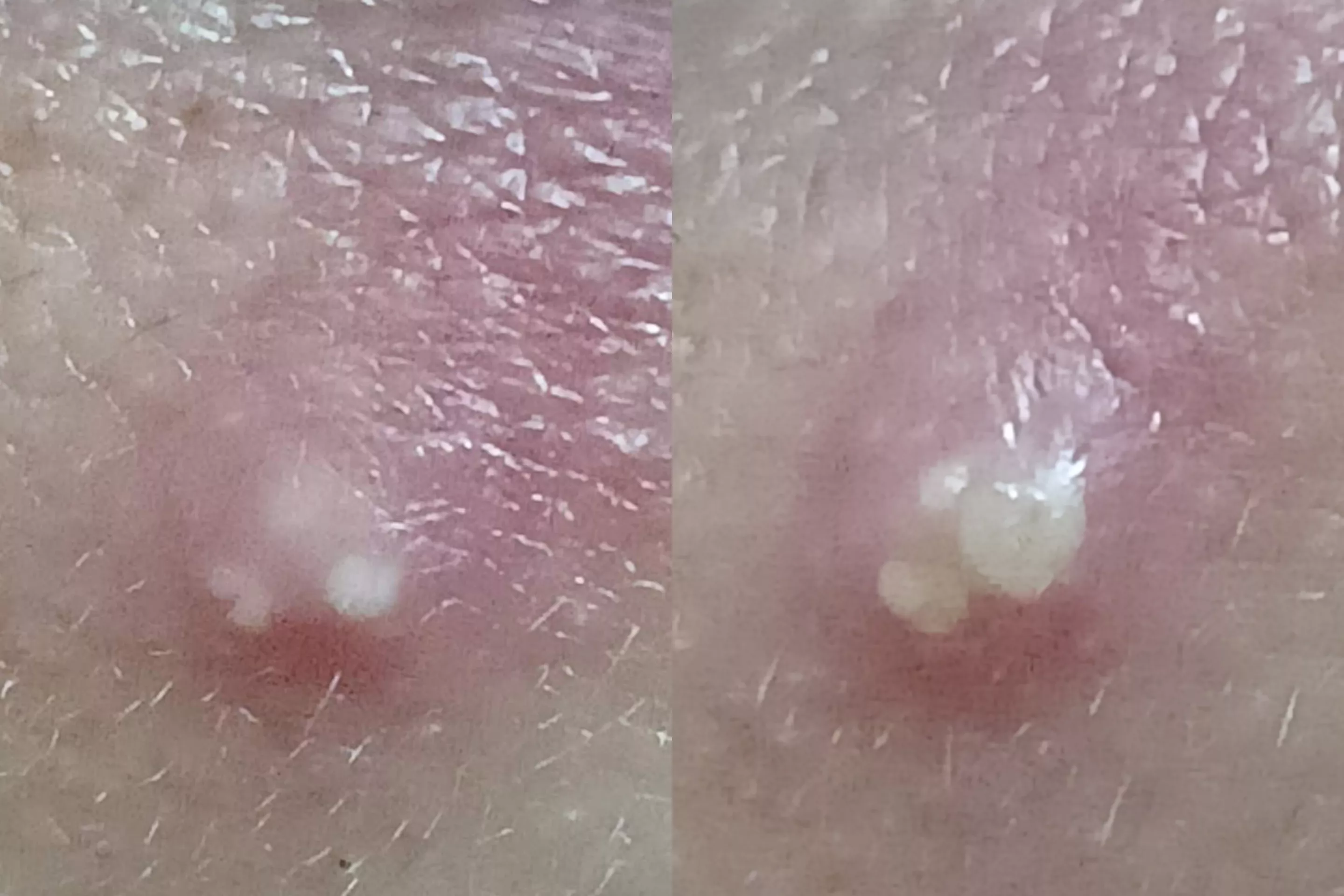 my my, look how she grows [pic] [pimple on lower lip]