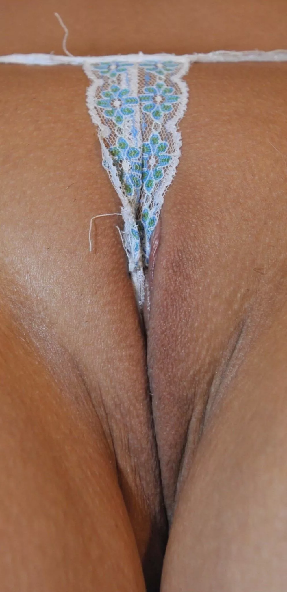 Right amount of coverage