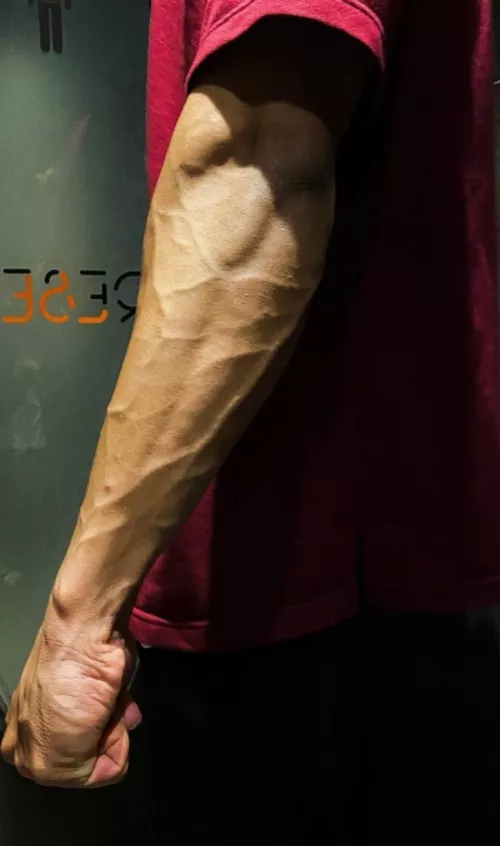 veins look like thunder