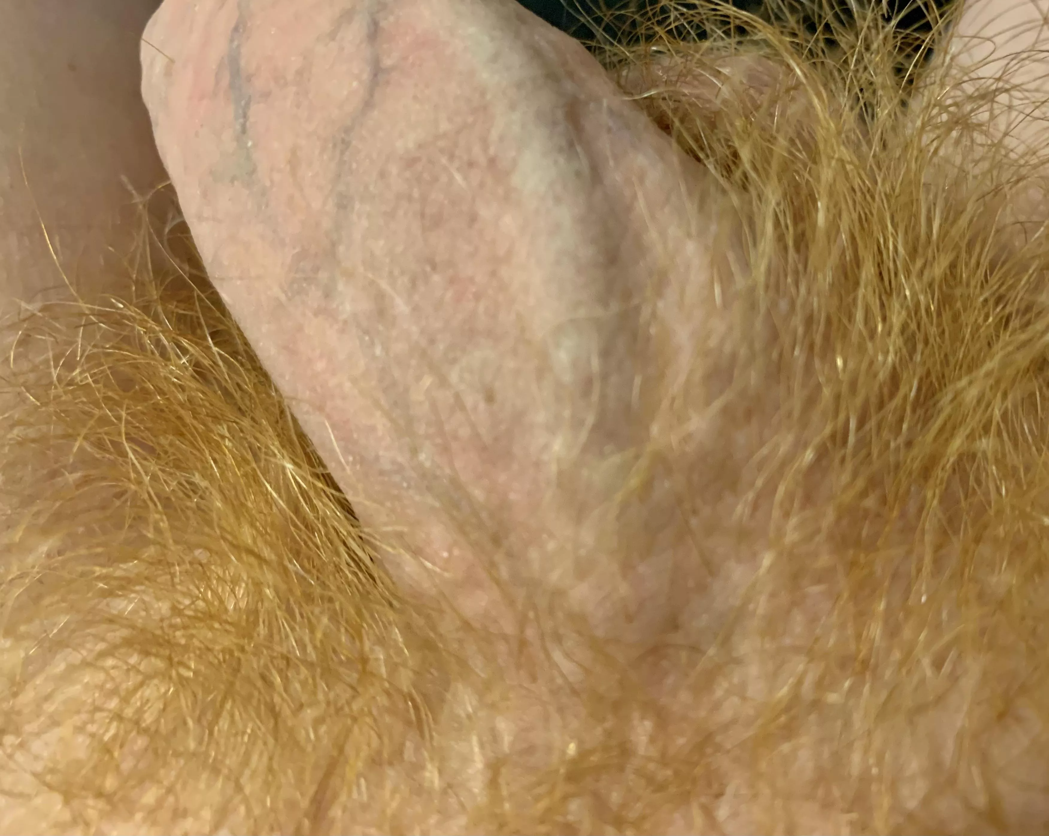 Veiny Bush
