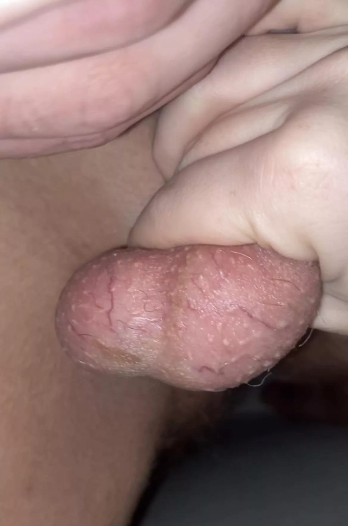 His young balls are nice and red, what should i do next?