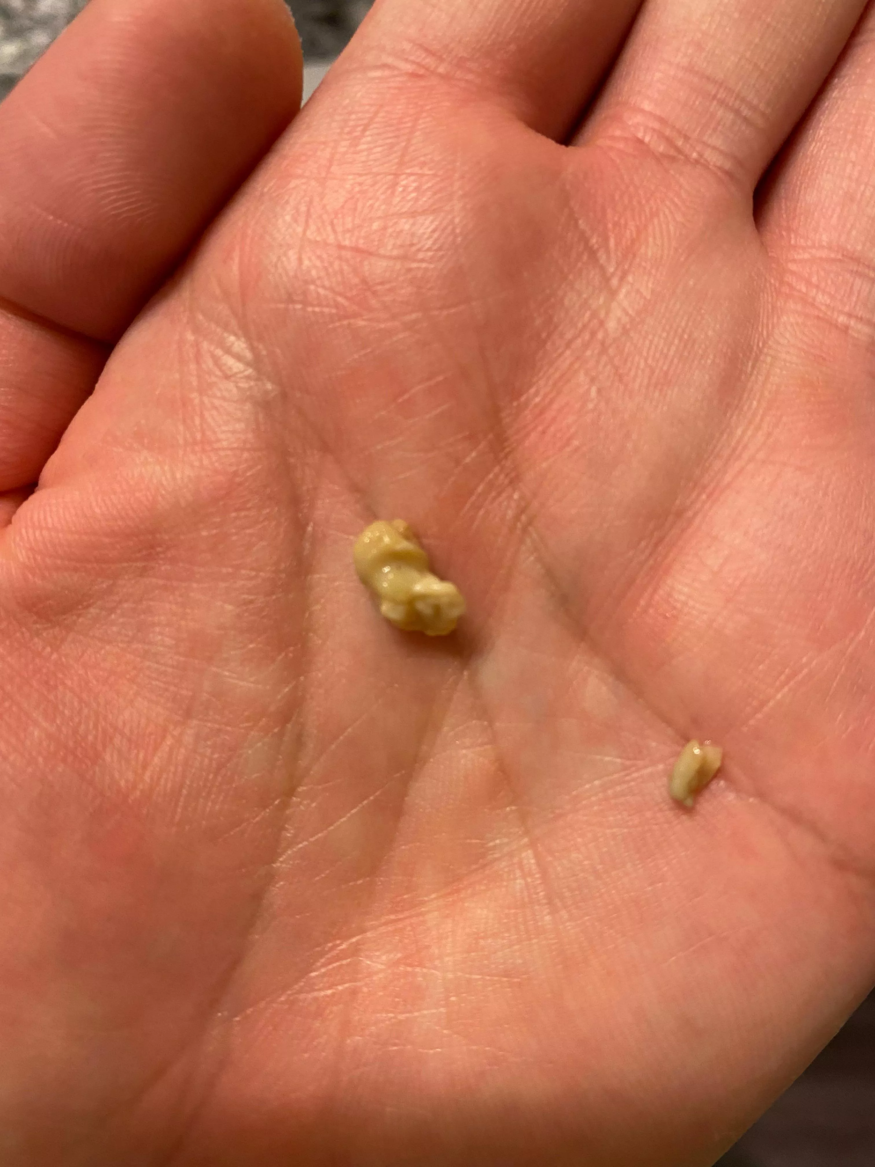 Fished this monster out of my tonsil with a q tip