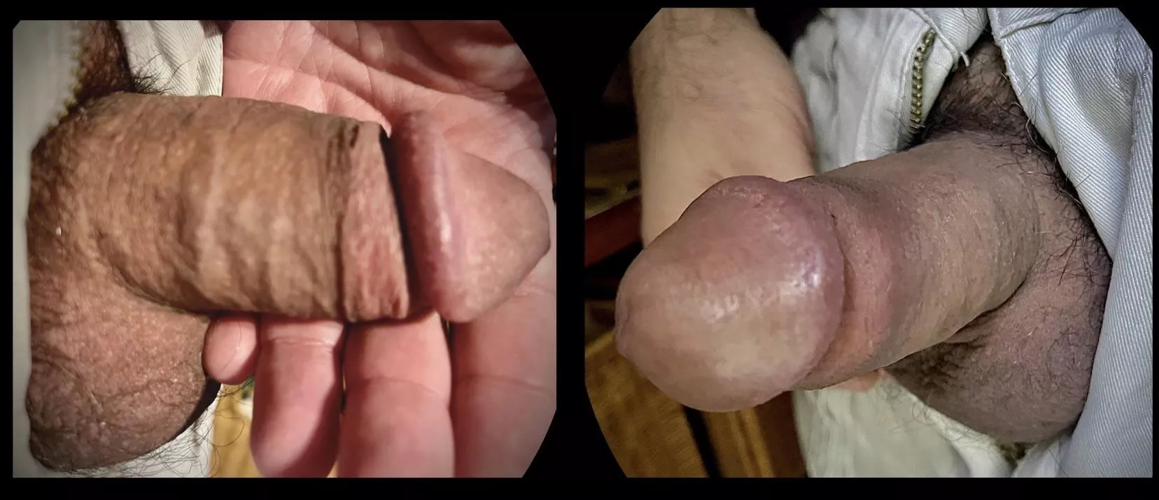 Acorn Grower Starting from a Half-Mast Morning Chub