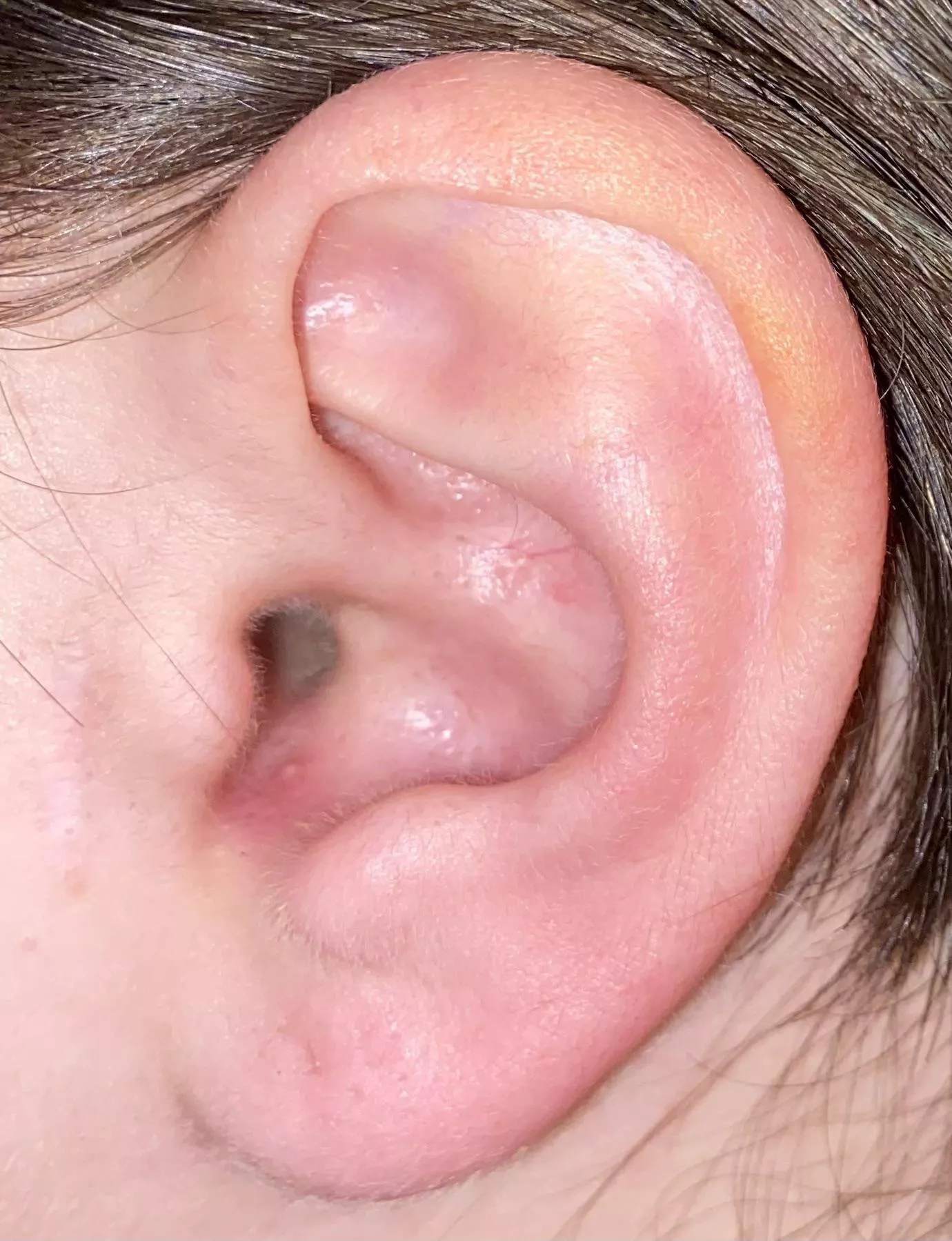 I have swimmer’s ear and this showed up…forbidden pop :(
