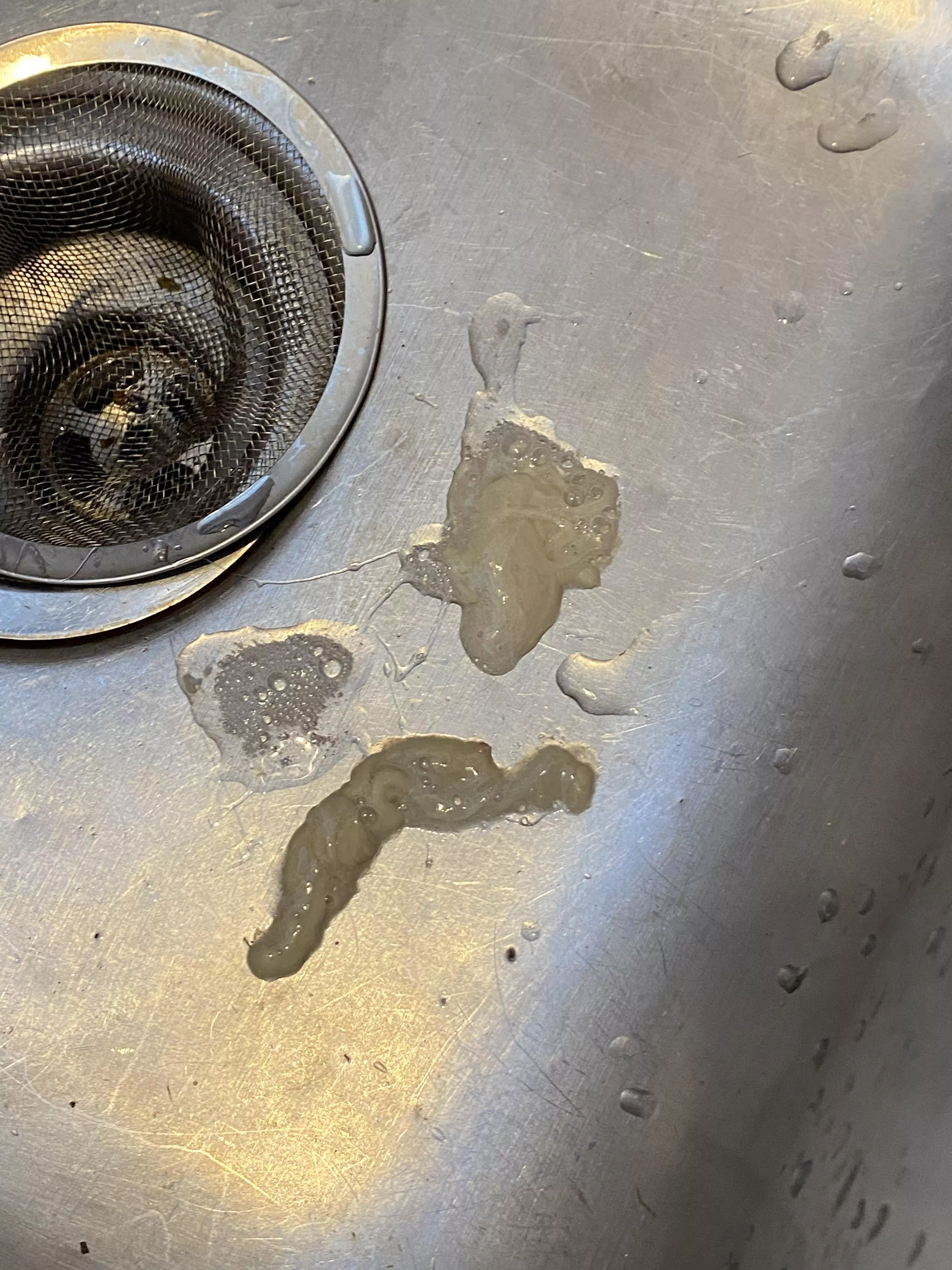 Largest snot I have ever seen from my 7 year old. Sorry this is a photo and not a video! I have no idea what this is, regular snot? Sinus infection? Pieces of his brain?