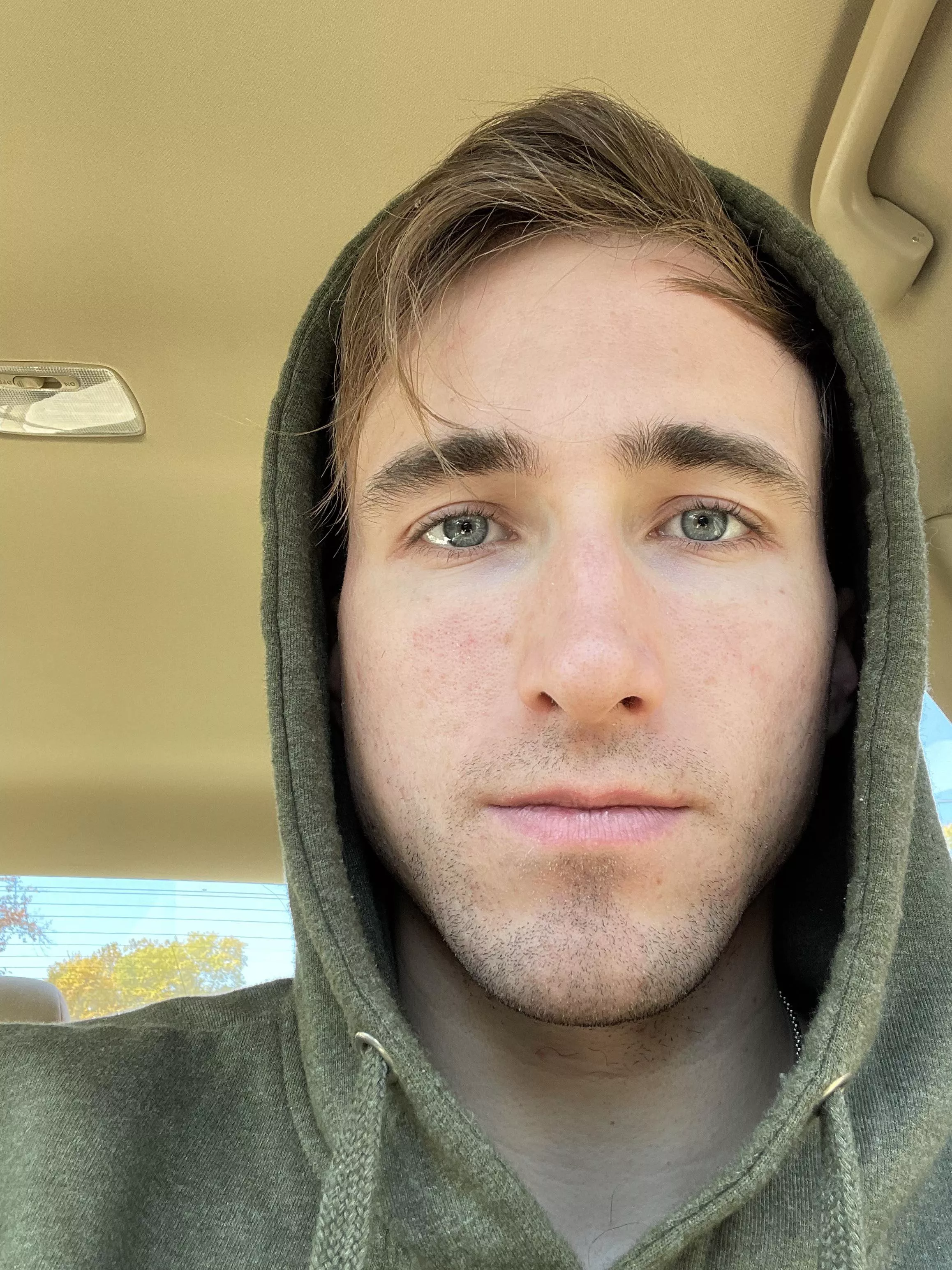 Chapped lips oh well 🤷‍♂️ 😘