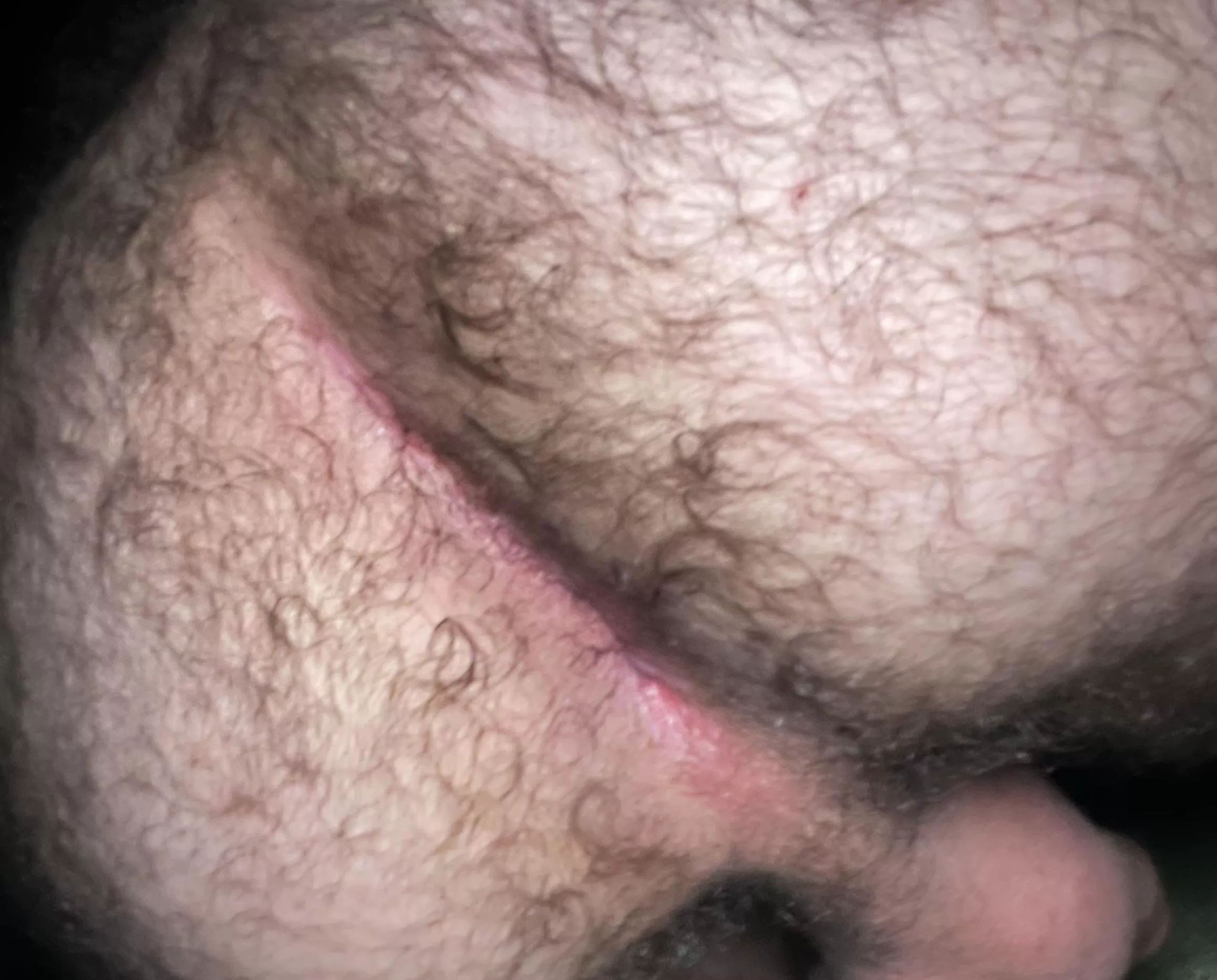 (23) my hole needs to be used. DMs open