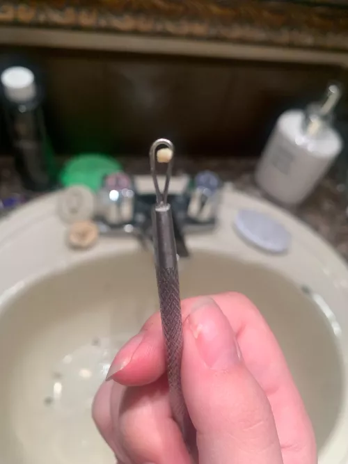 Doing my routine stone popping and this absolute boulder pops out. I didn’t even feel it was there.