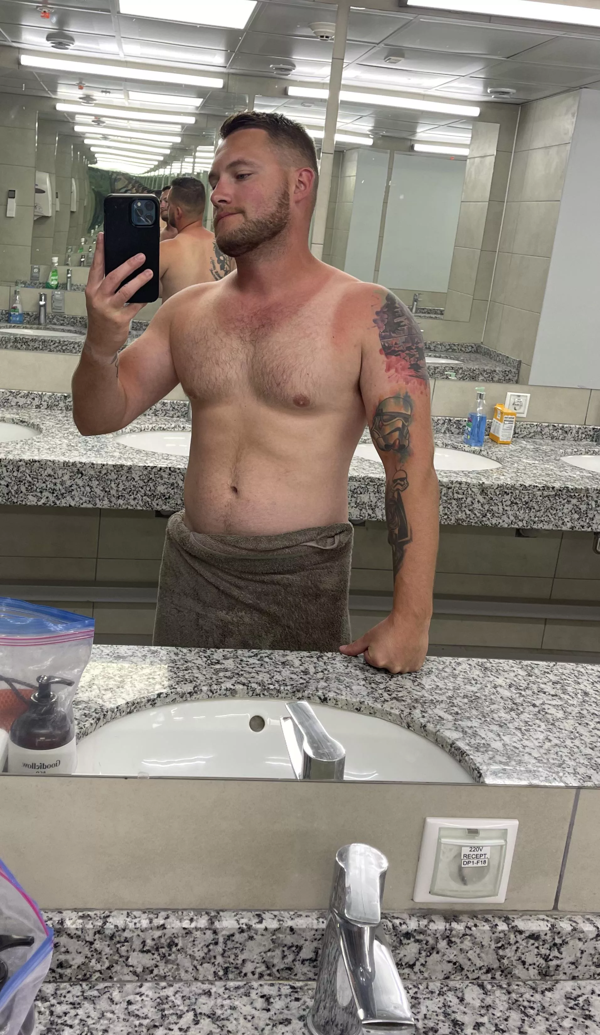 I got a little sun burnt today. Them tan line though 😂 [30]