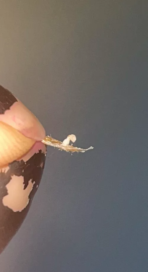 Pulled off a scab and out came the sack!