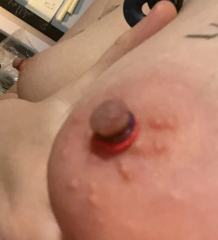 some rubber band fun