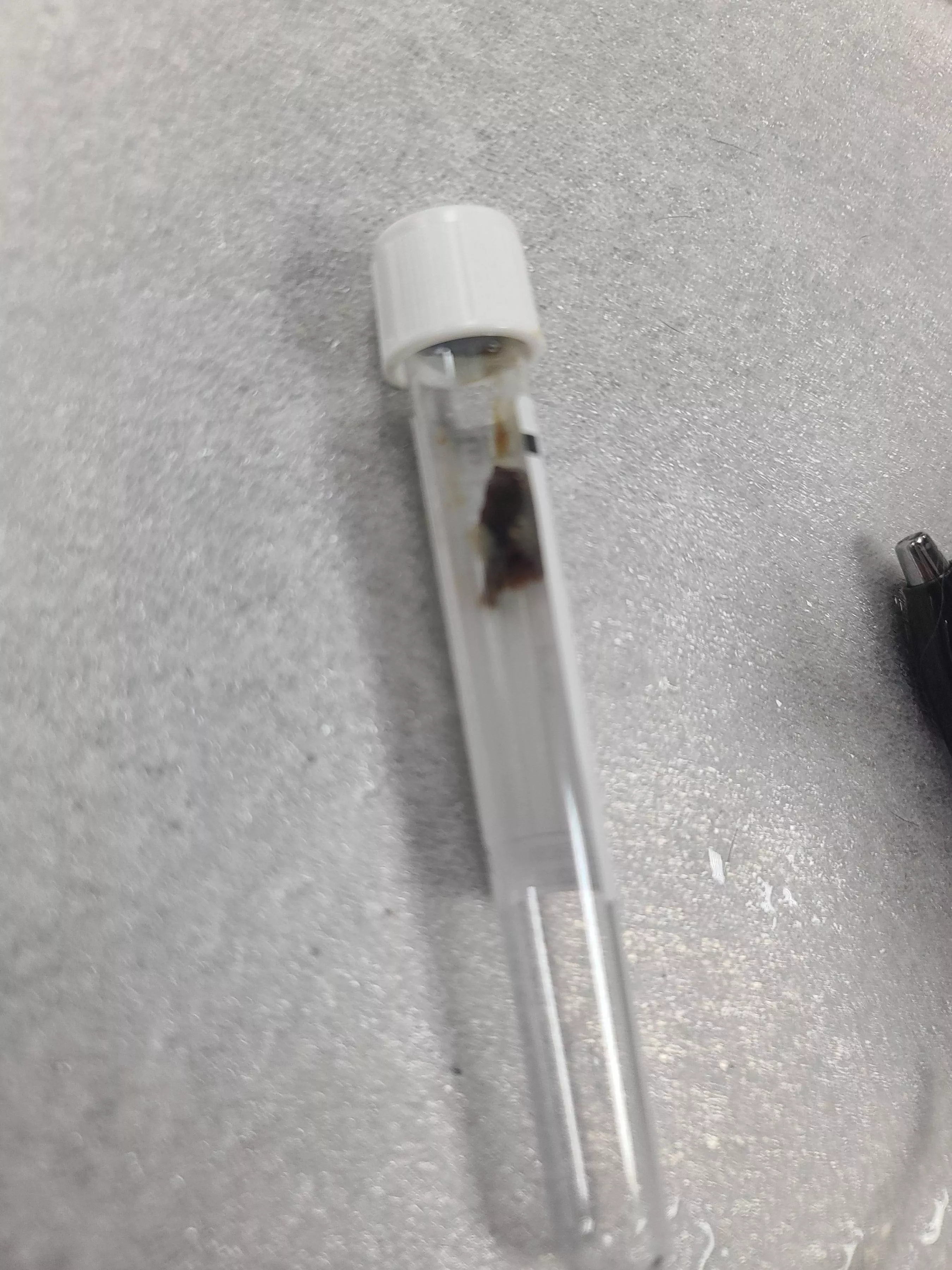 I flushed my colleague's ears today and got this giant nugget!