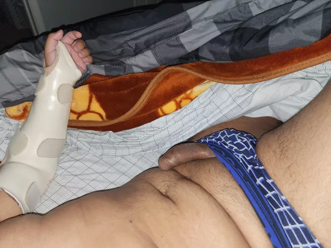 Broken hand. Morning wood.