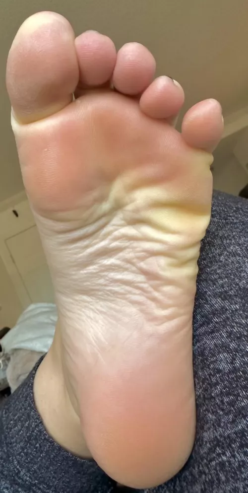 Count the number of wrinkles… closest guess wins a prize