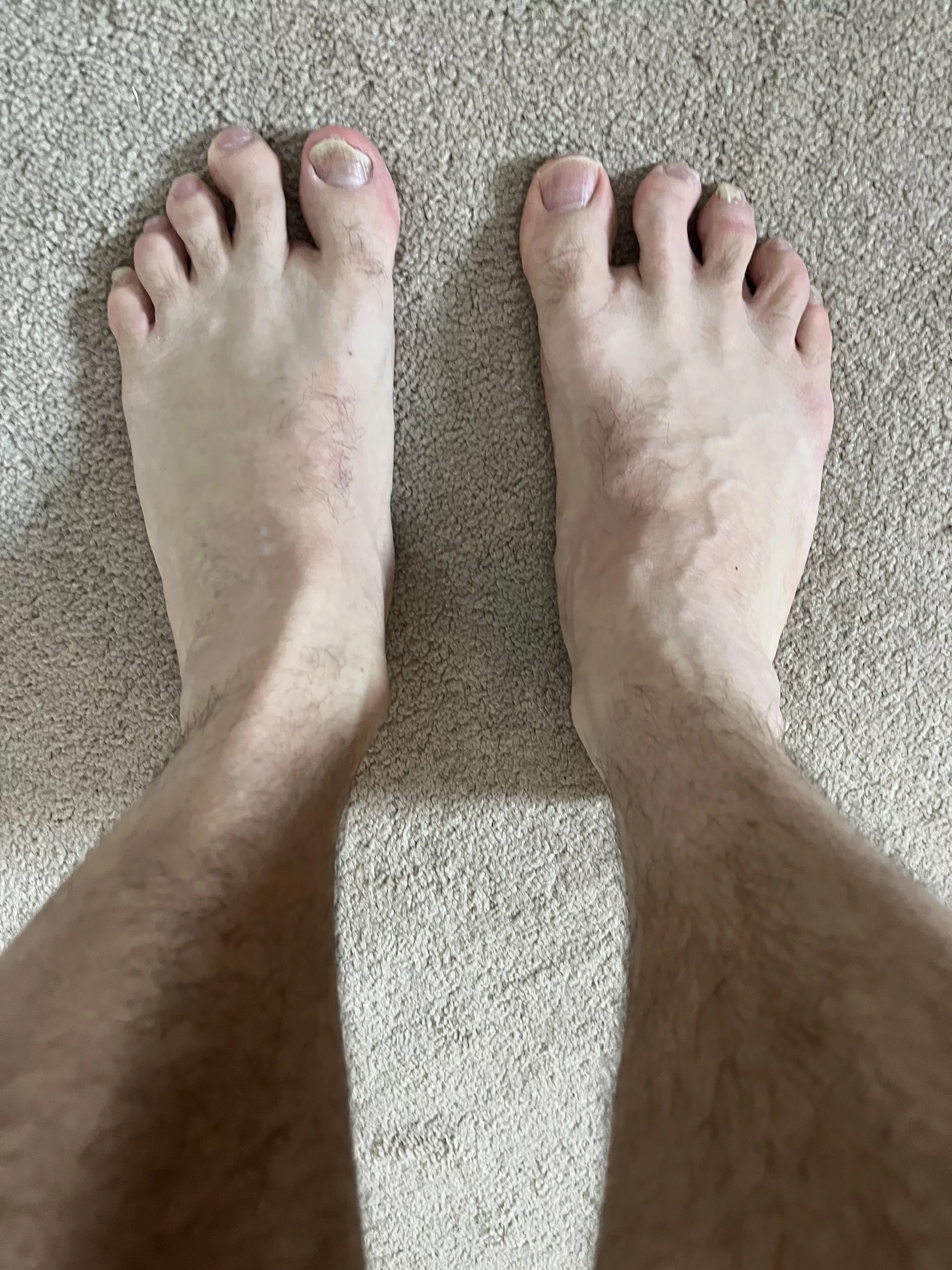 Do you like my feet?