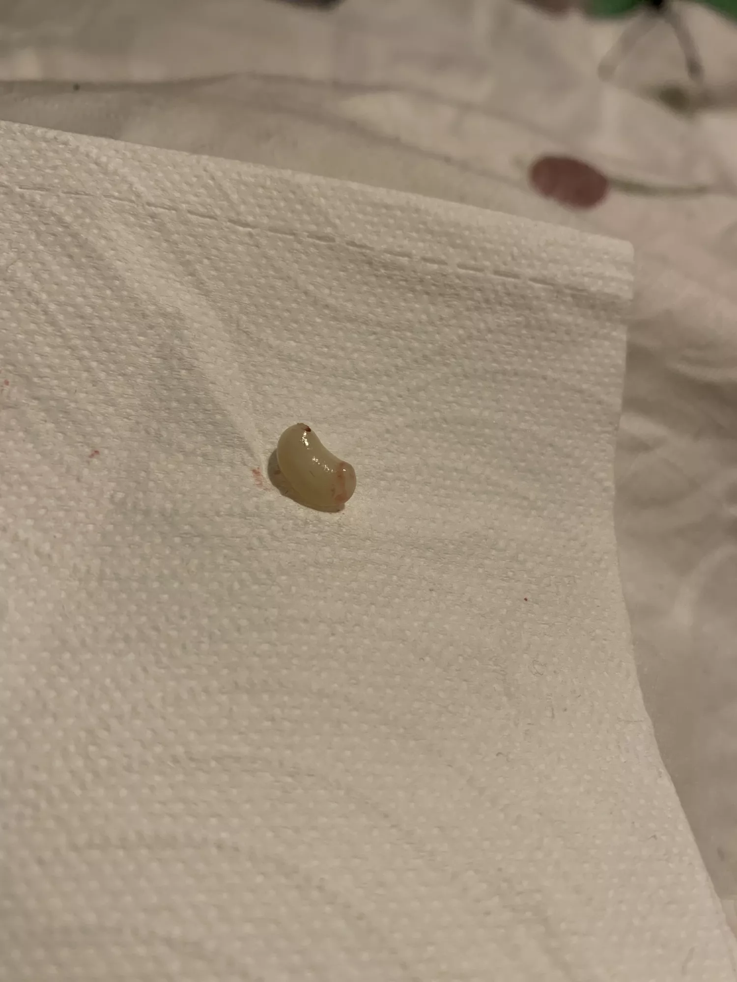 I had a cyst on my labia majora that came to a head. Couldn’t record the actual pop as I didn’t have a free hand but this is what popped out when I squeezed! I think I got the sac!