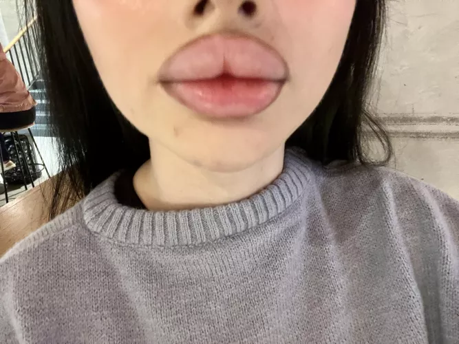 My big lips want your attention right now