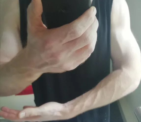 Bit blurry but certainly vascular 👌