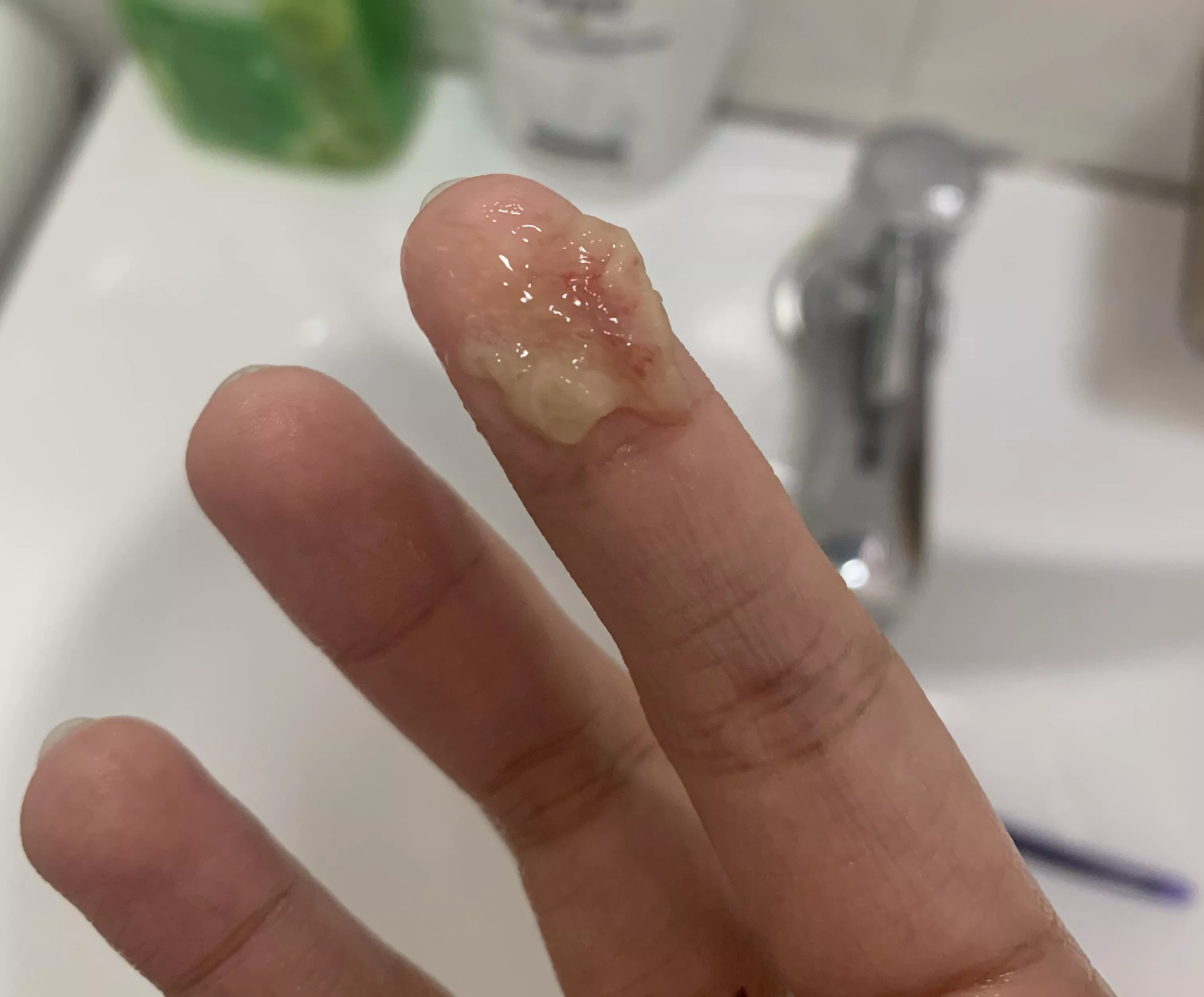 i know maybe i’m in a wrong group but i just blew this out of my nose after having a high fever last night and having that cloggy feeling in my throat since yesterday, help pls? 😭😭