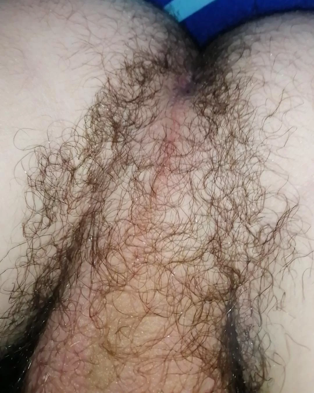 my bum is kinda hairy hehe