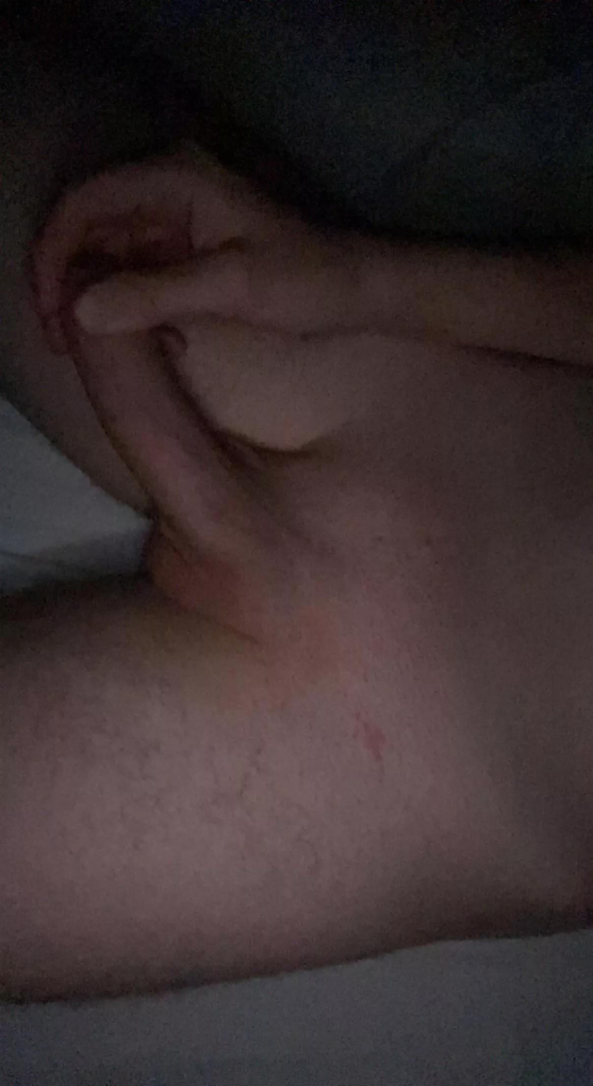 18yo foreskin reveal?? 😮