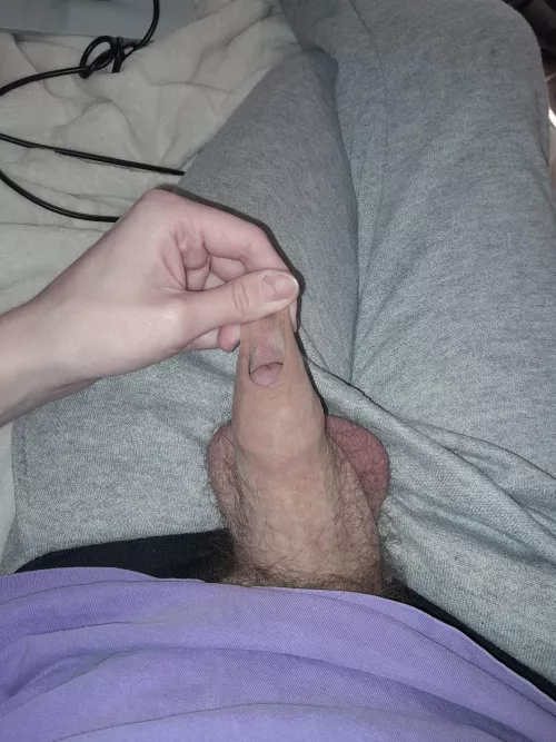 [26] foreskin restoration progress!