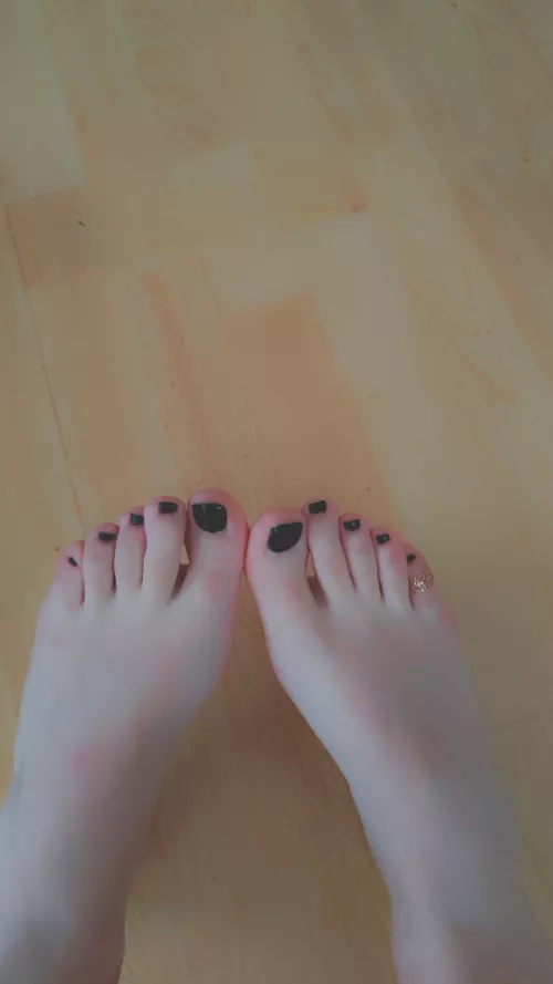 black toes anyone?