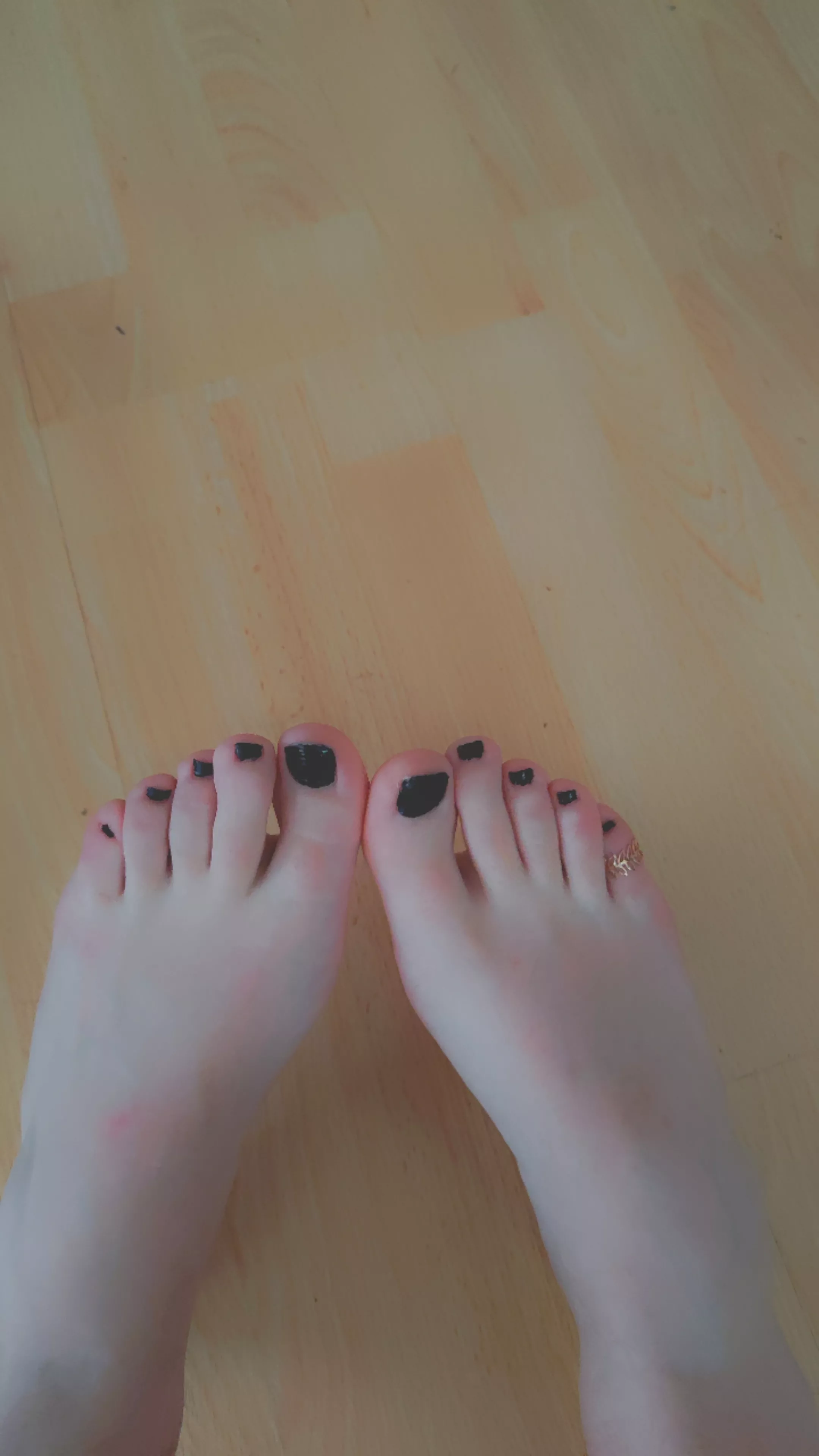 black toes anyone?