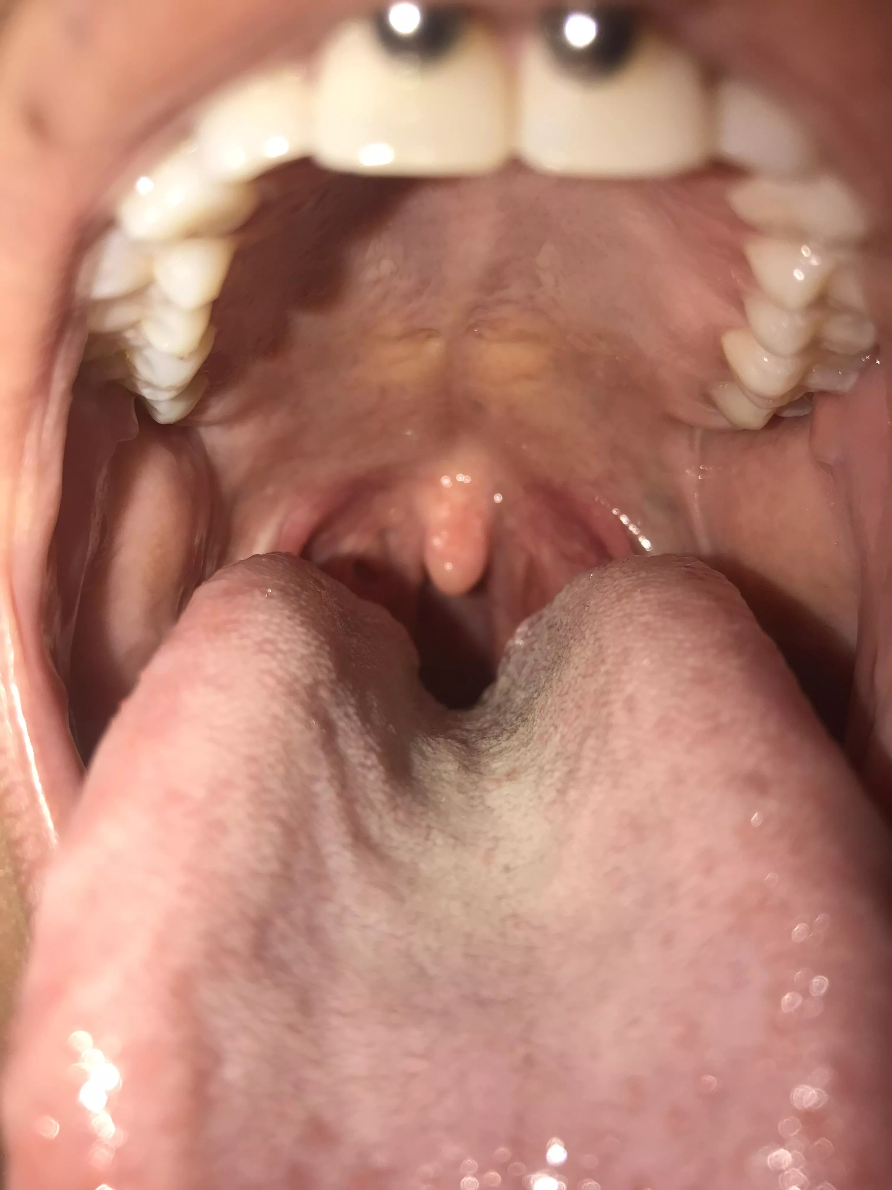 {Image} Are you getting down my throat?