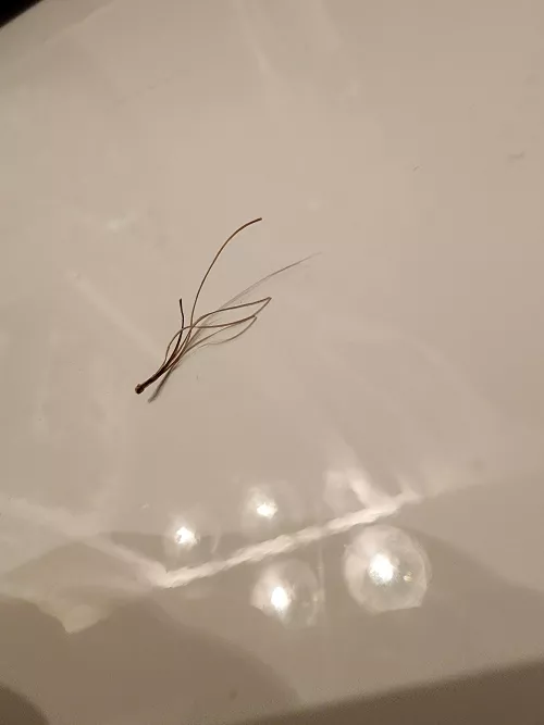 Sorry I didn't video it. One hair follicle squeeze produced this glorious bastard.