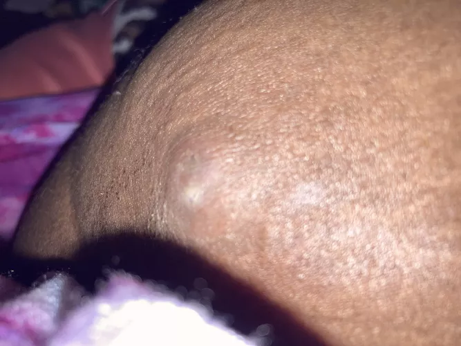 please help, how do i get rid of this asap? read my comment for details