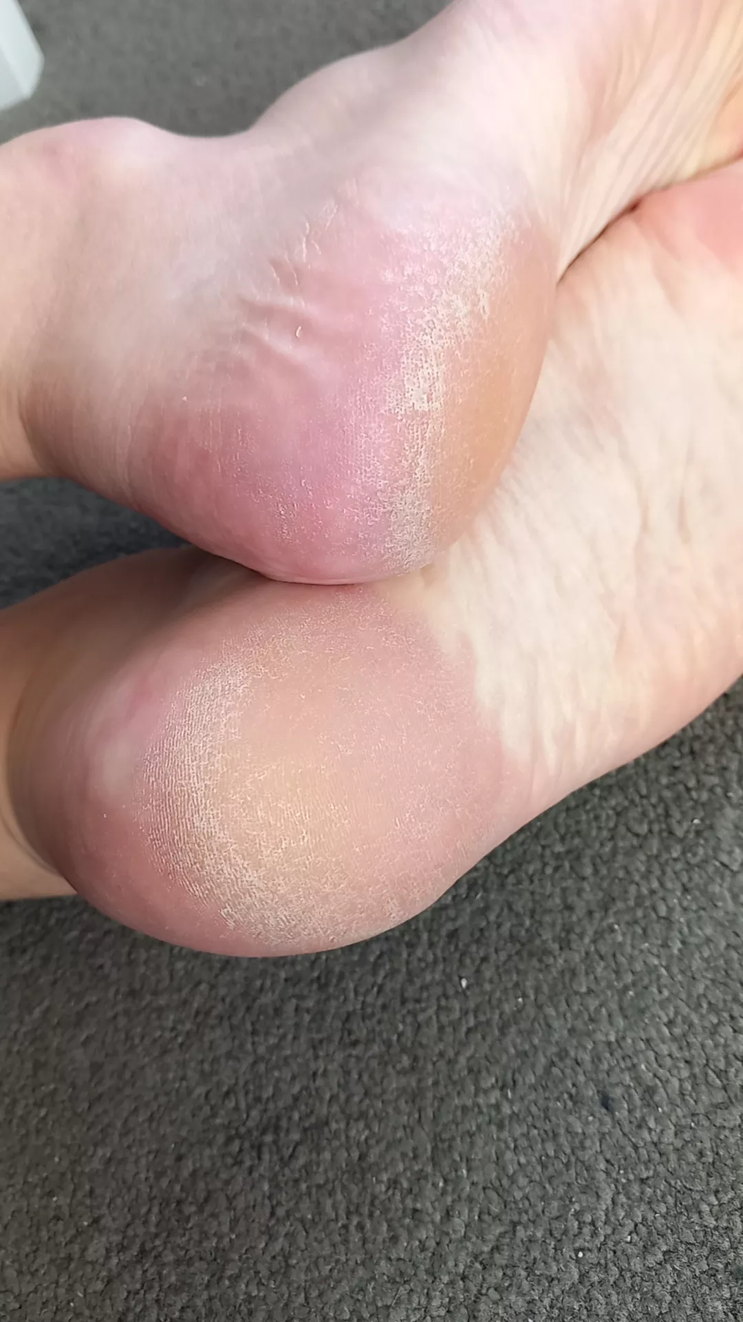 rough heels ..wanna lick?