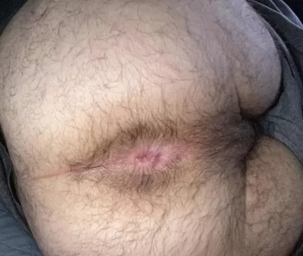 Let me help you fail NNN