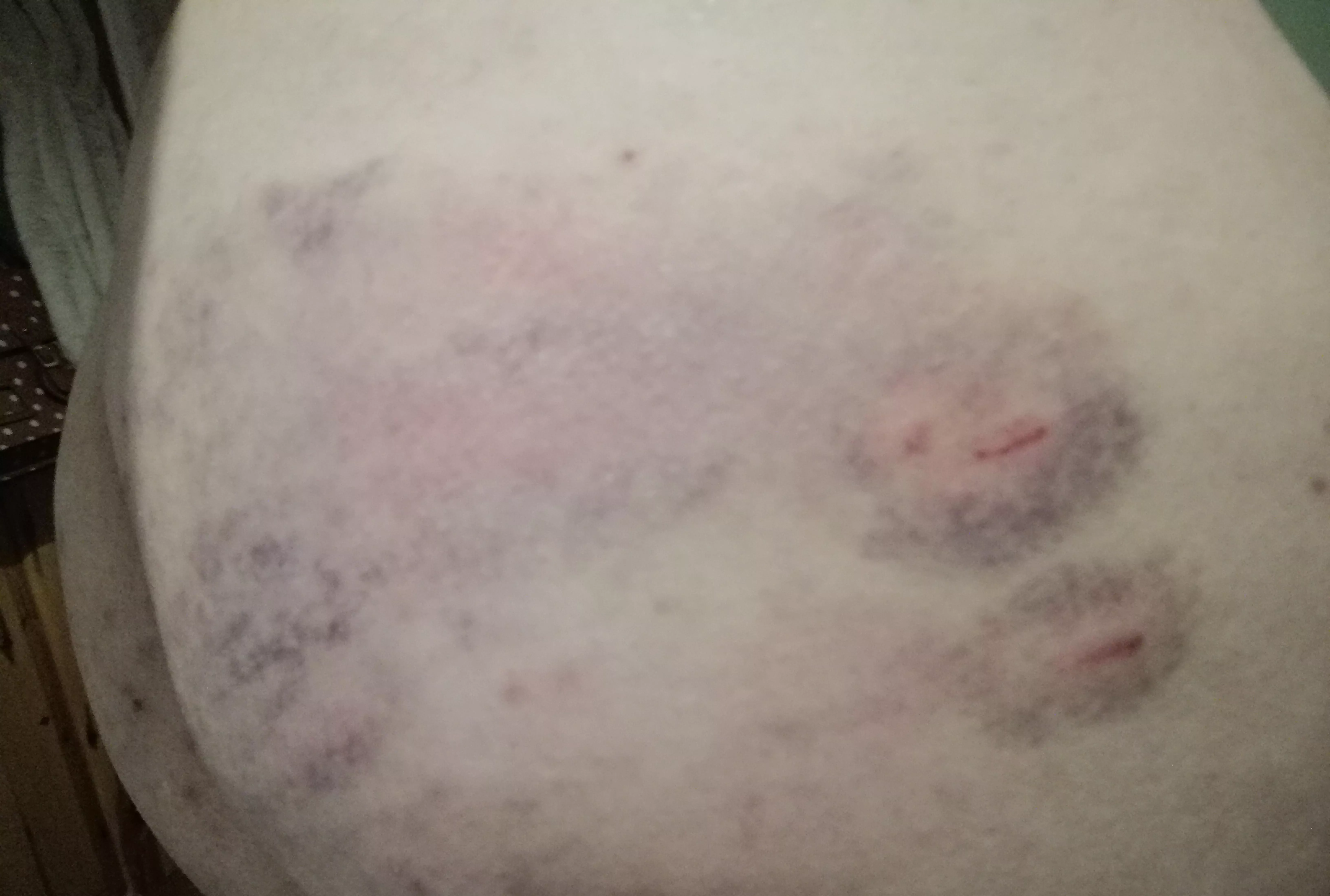 Took my first proper beating at the weekend - flogging, punching and caning! Hope I'm in the right place to share!