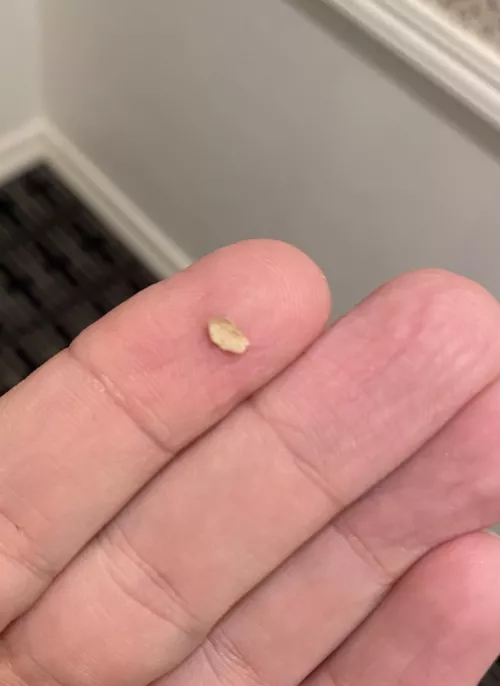 A giant chunk of plaque I just chipped off my tooth