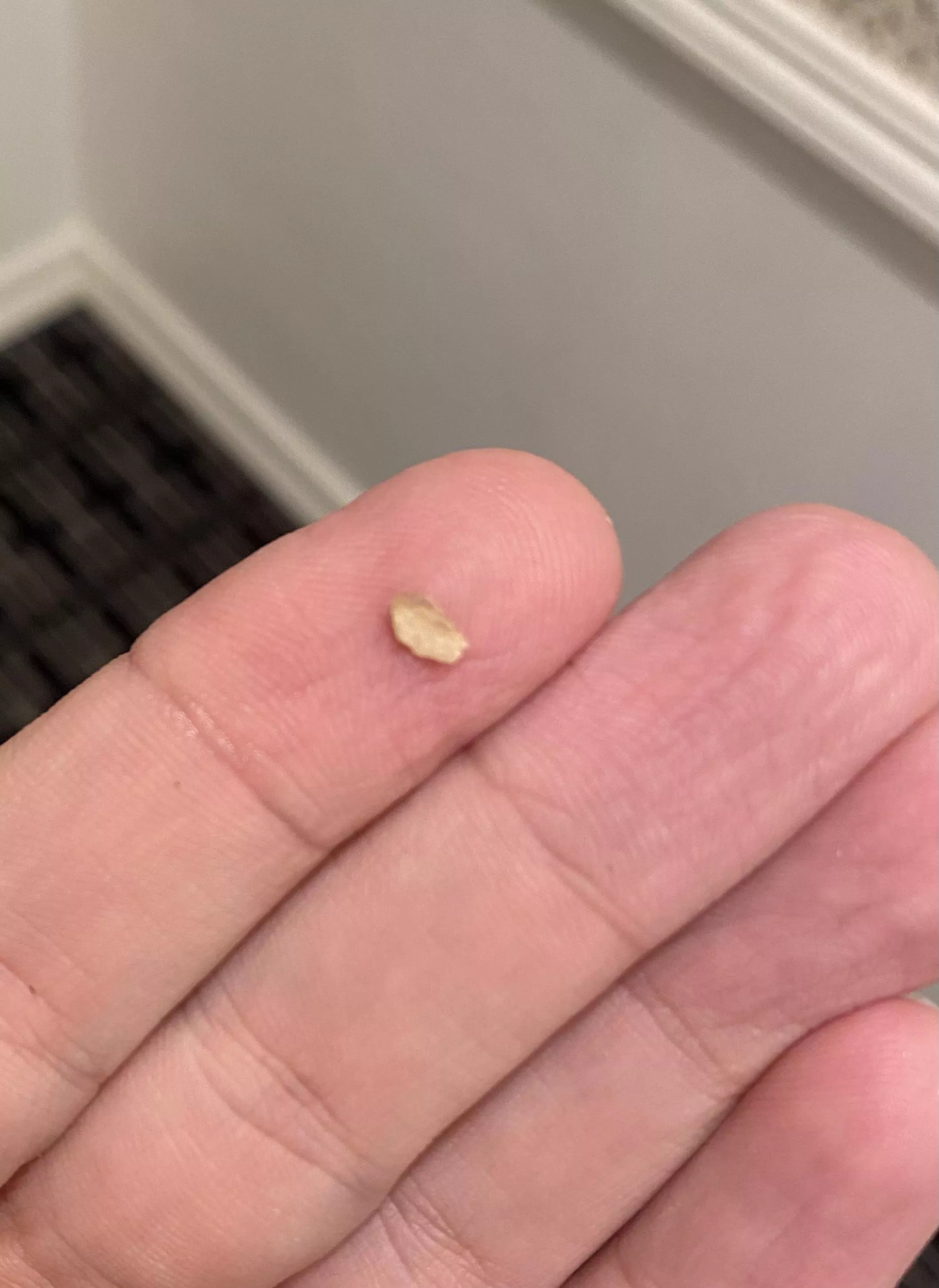 A giant chunk of plaque I just chipped off my tooth