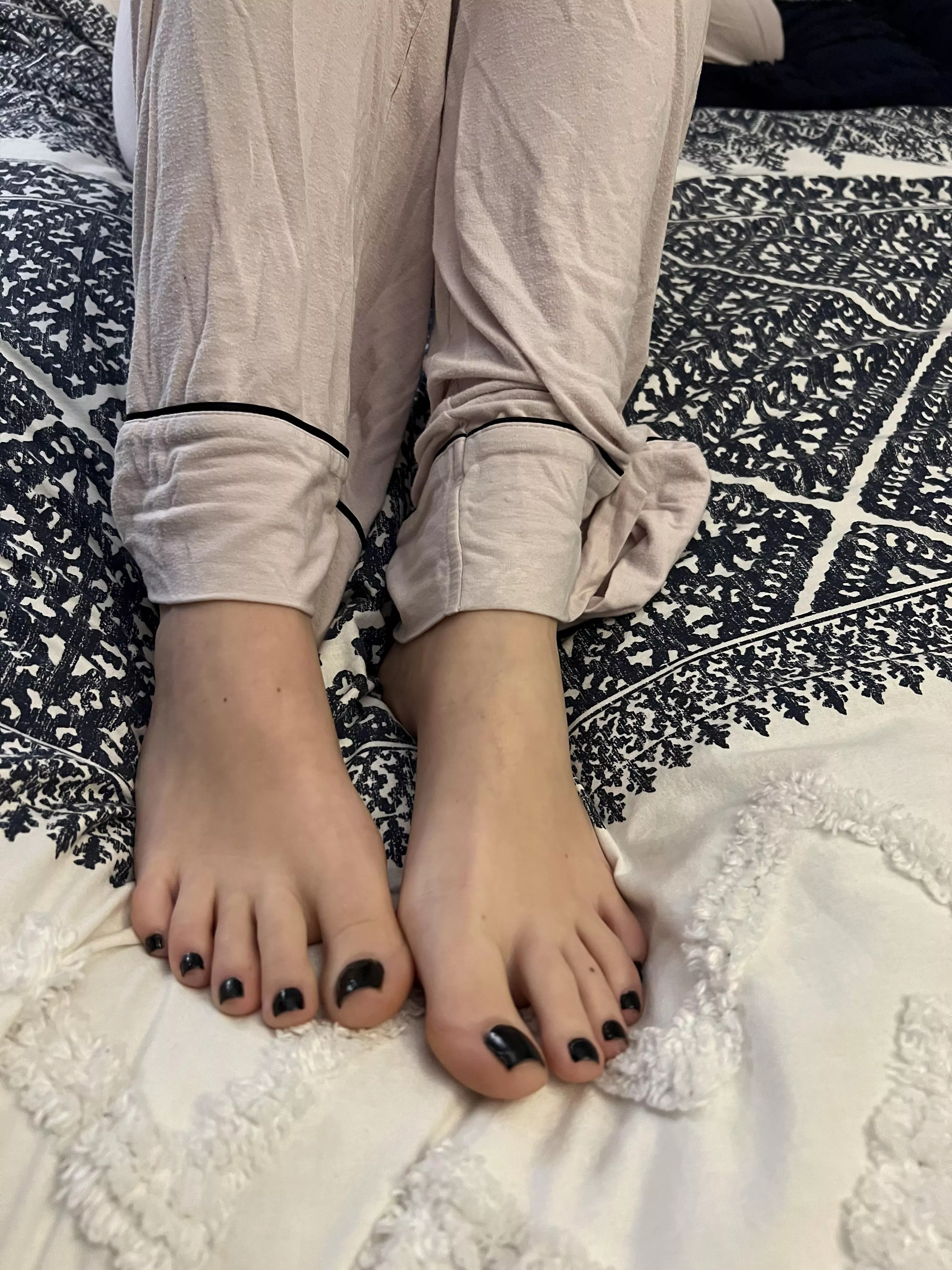 Bed time, but first these toes need some attention
