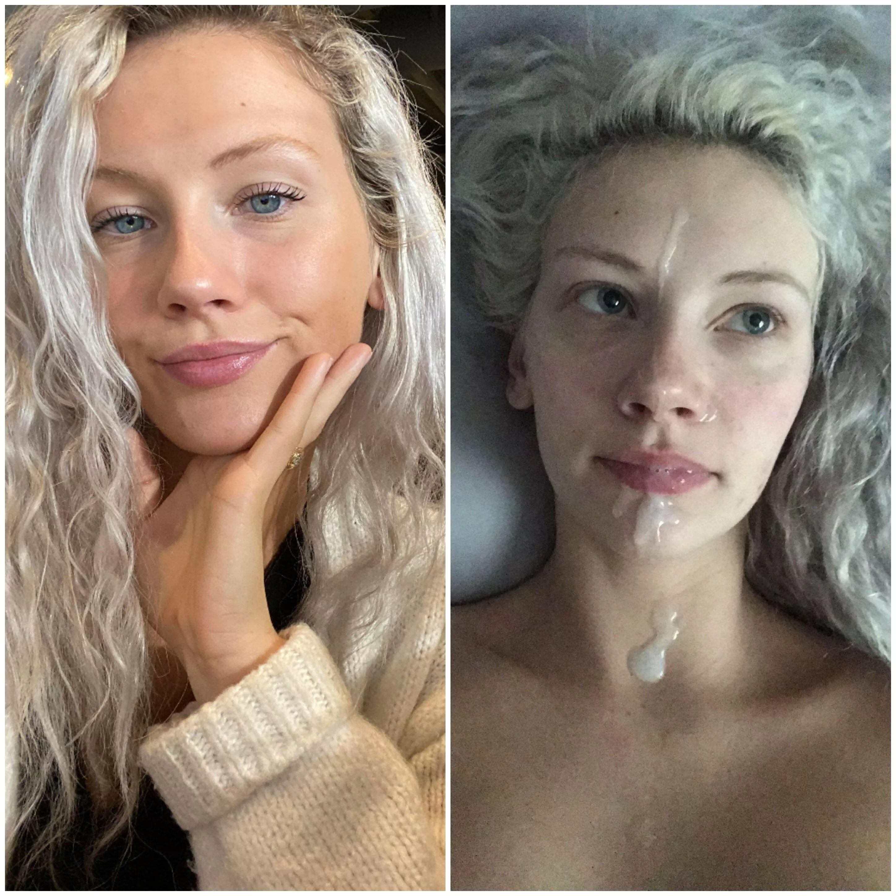 Before & after facial