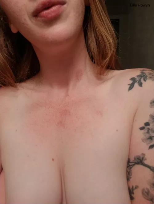 Covered in freckles and hickies