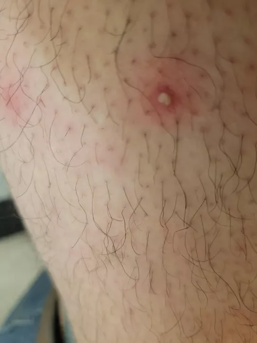 Can't wait to get home from work and give this bad boy a squeeze. Hurts like hell. Plan on recording for you folks.