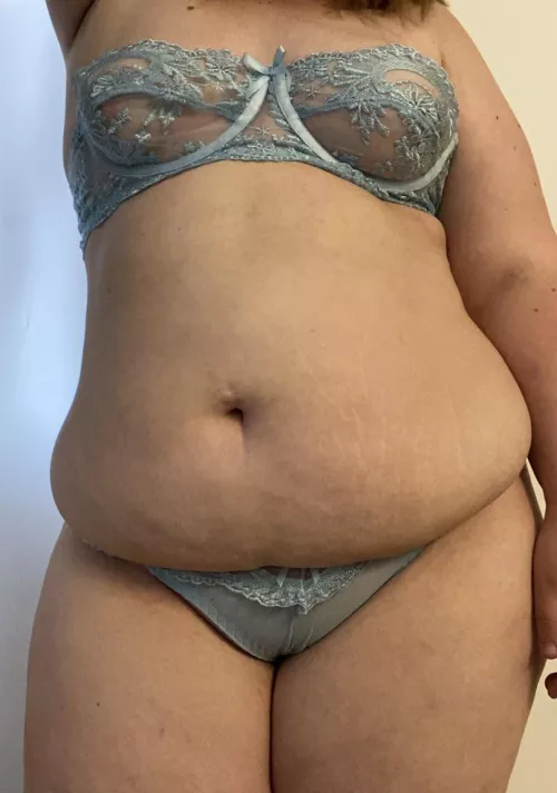 Hope you don’t mind scars and softness ✨