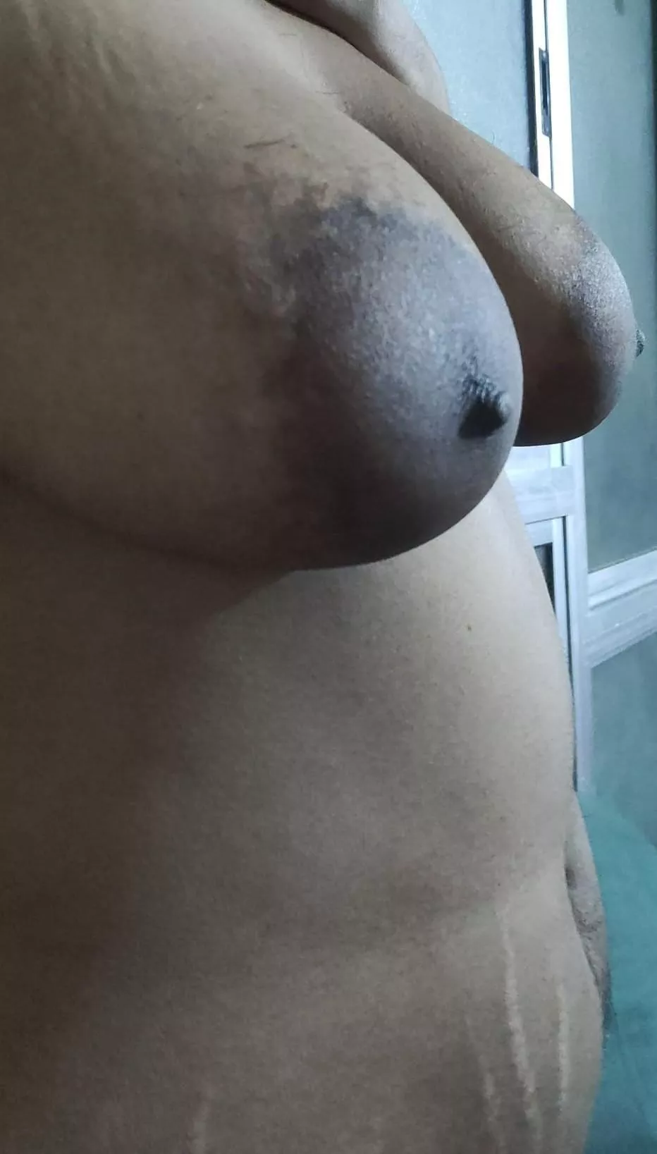 I'm hairy at wrong places 😞