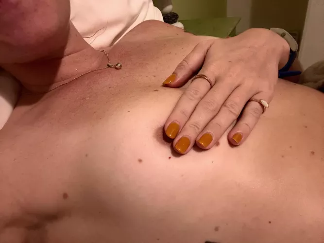 Lots of freckles on chest