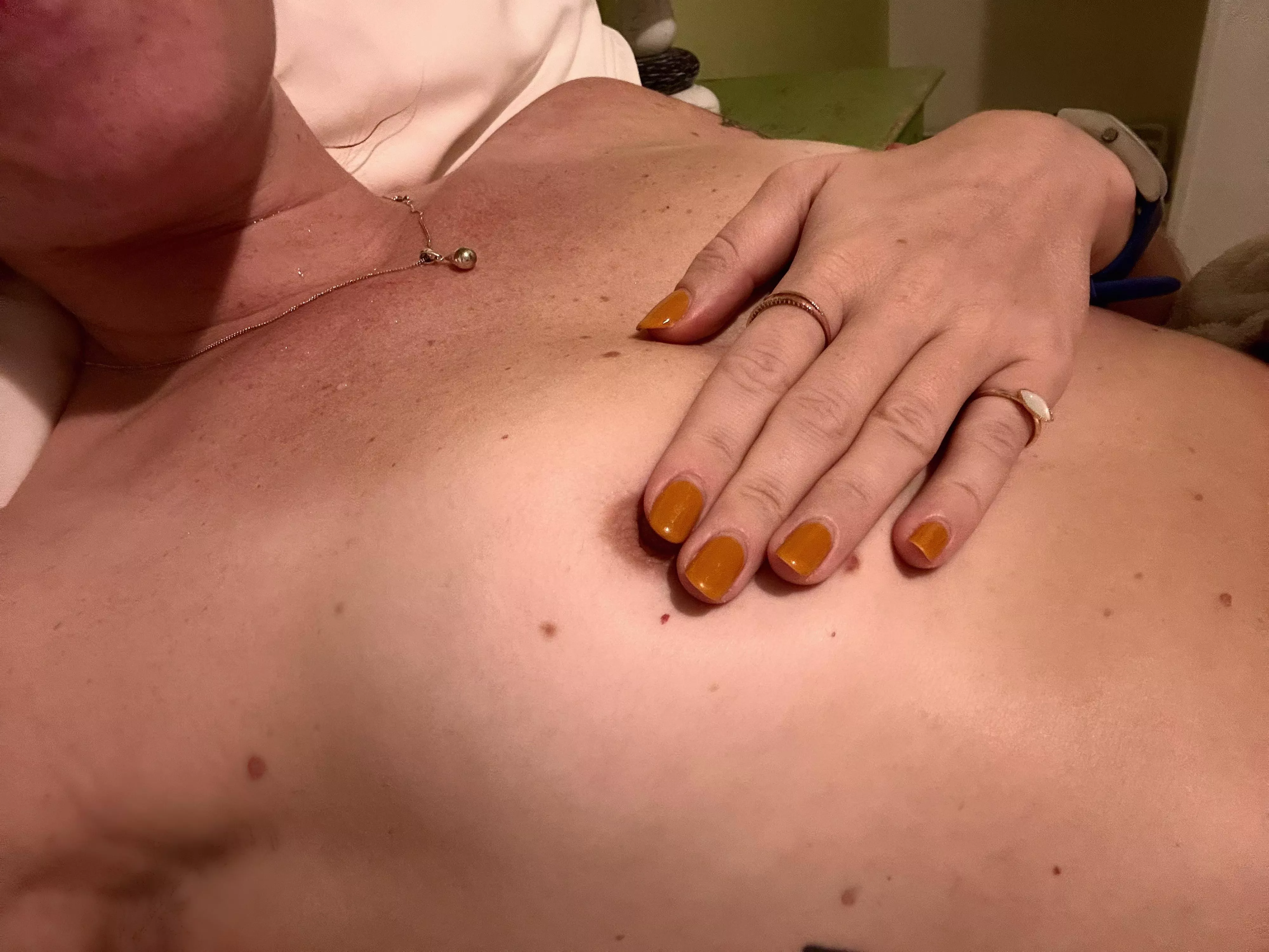 Lots of freckles on chest