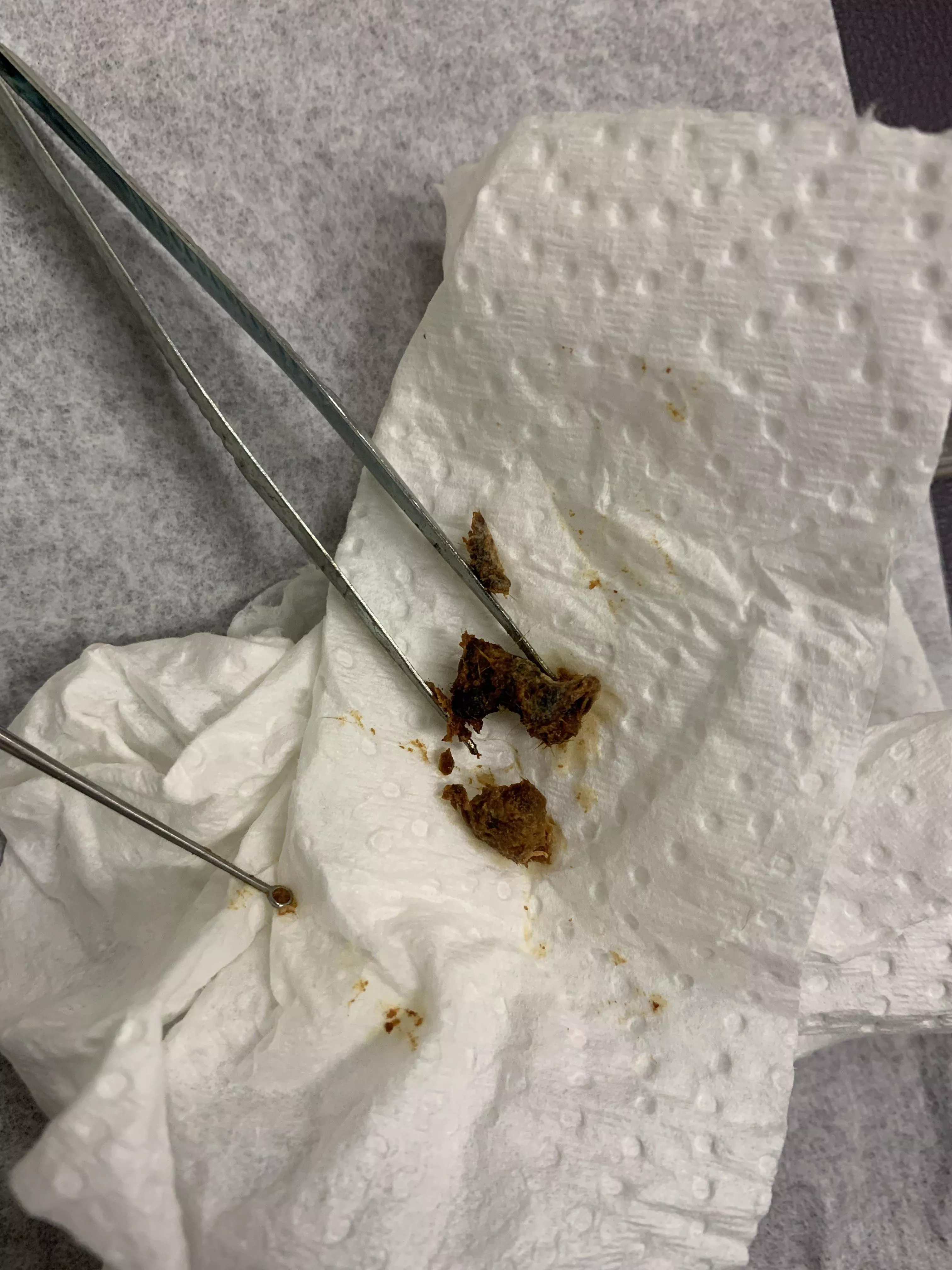 My first post. I didn’t have the courage to ask to film the extraction. The other ear had a bigger plug that was removed!