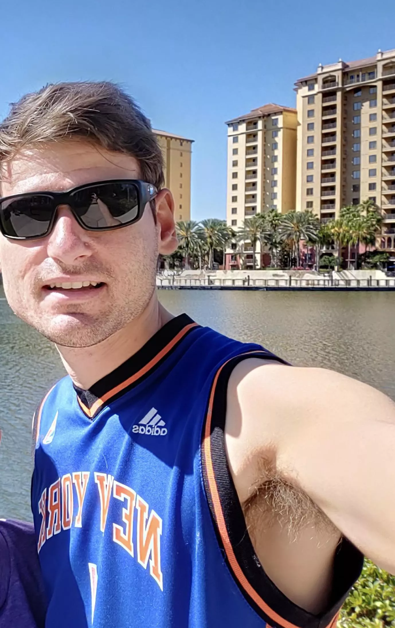 Should he always be exposing his armpit?