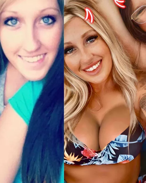 (30F) Bimbo Milf Transformation (Implants & Fillers)