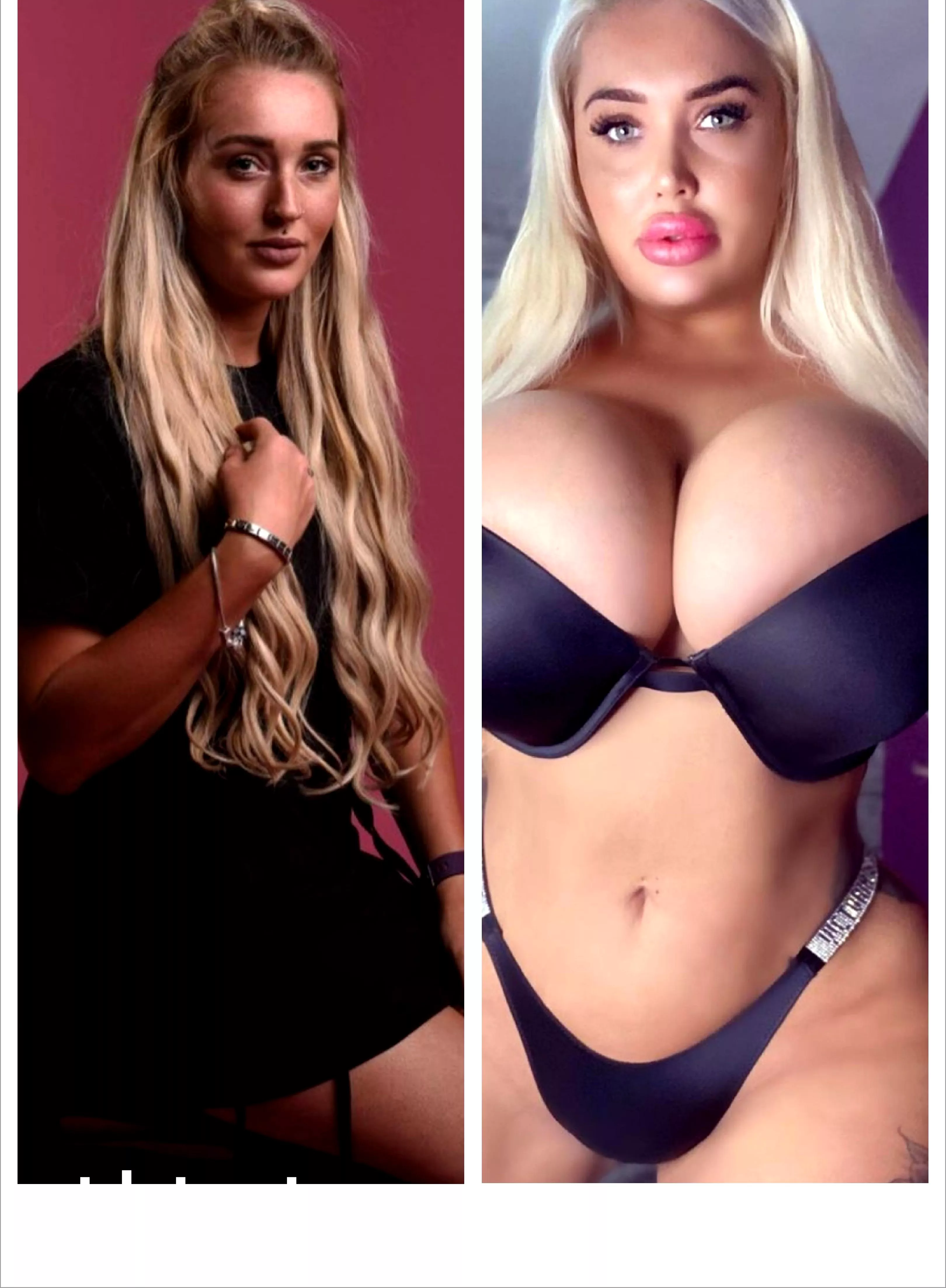 Amber Mwy rapid progression